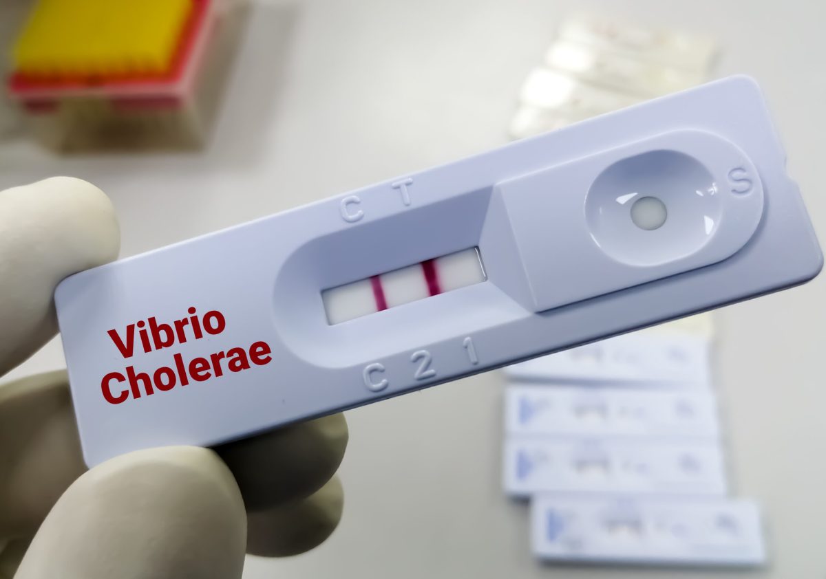 Vecteezy rapid test device or cassette for vibrio cholerae test show 13675293 scaled.jpg