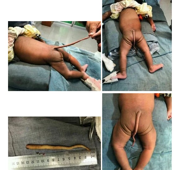 Bebe com cauda.jpg