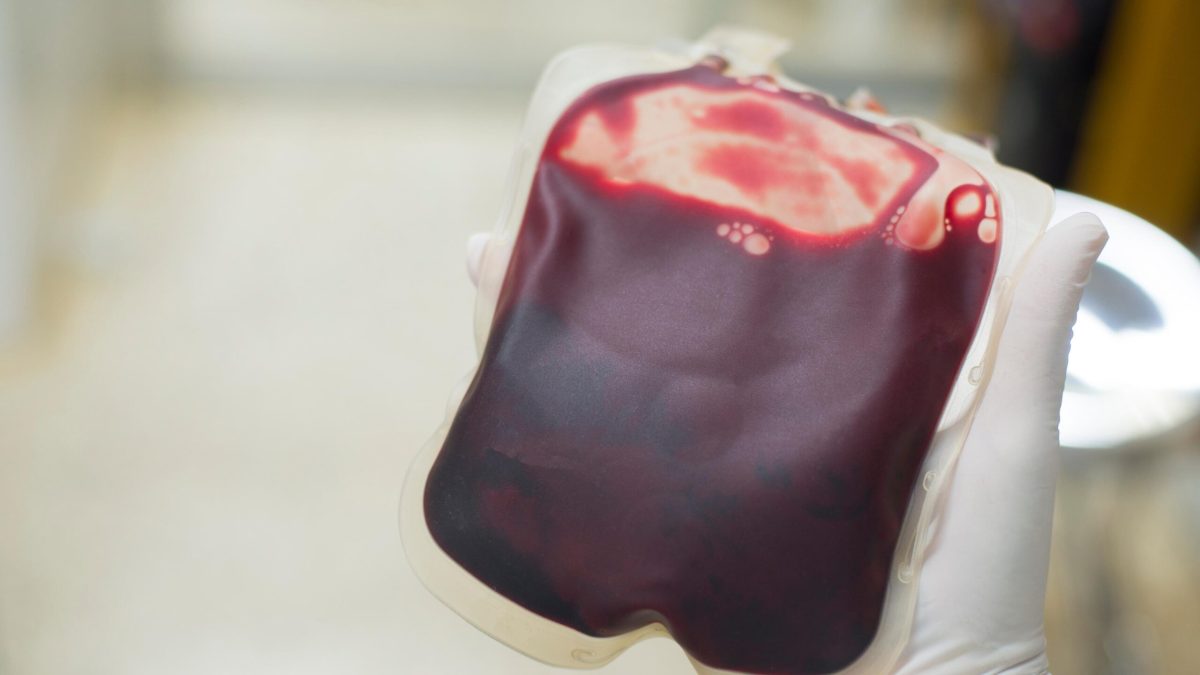 Vecteezy blood bag donation centre transfusion concept lifesaving 34594905 scaled.jpg